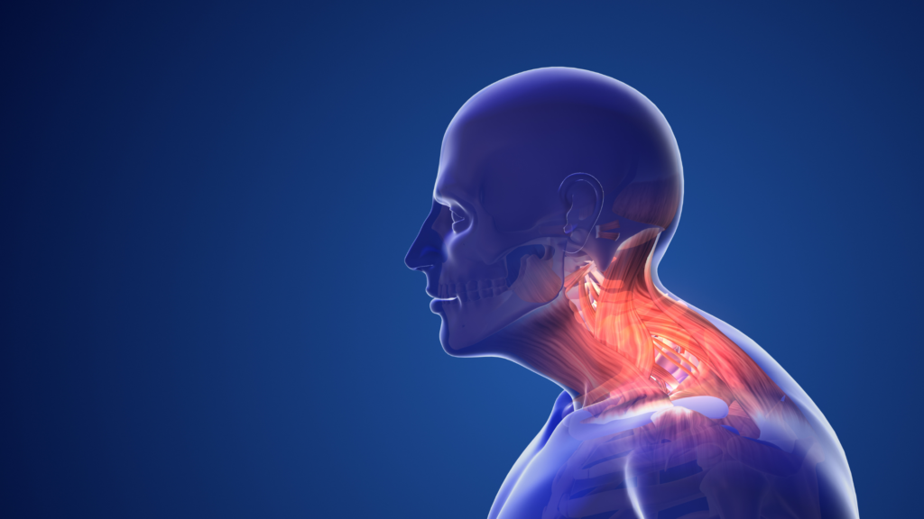 How Posture Affects Neck Pain